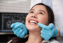 All-on-4 Dental Implants: A Complete Guide to Full-Arch Tooth Replacement