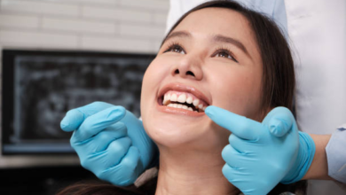 All-on-4 Dental Implants: A Complete Guide to Full-Arch Tooth Replacement