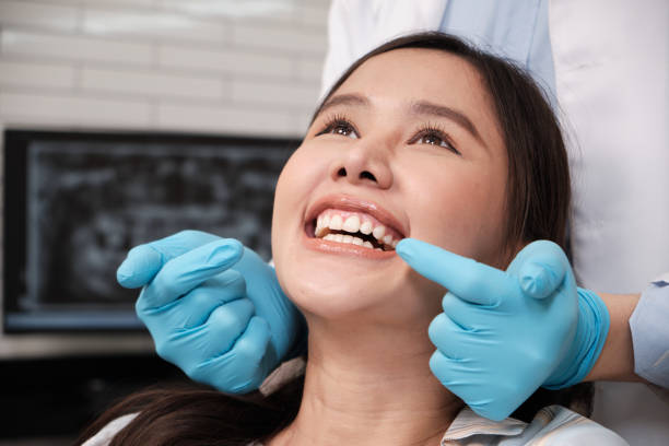 All-on-4 Dental Implants: A Complete Guide to Full-Arch Tooth Replacement