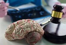 When Should You Hire a Brain Injury Attorney After an Accident?