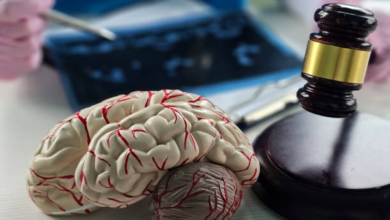 When Should You Hire a Brain Injury Attorney After an Accident?