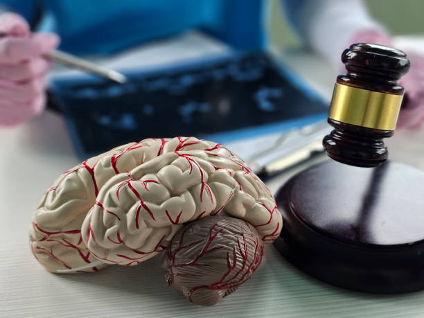 When Should You Hire a Brain Injury Attorney After an Accident?